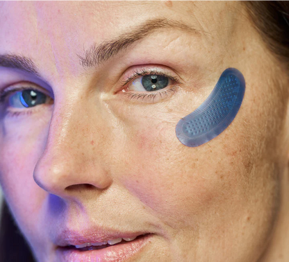 DermaFlect™ Microneedle Under-Eye Patches