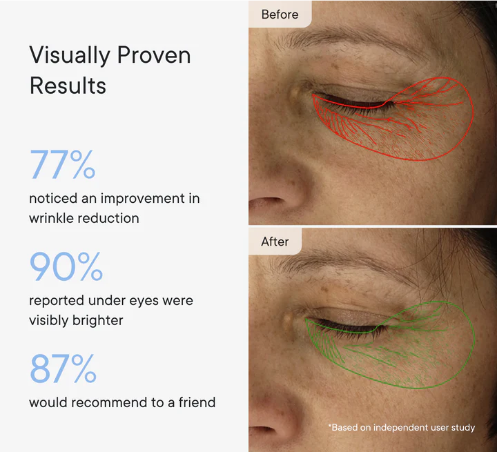 DermaFlect™ Microneedle Under-Eye Patches