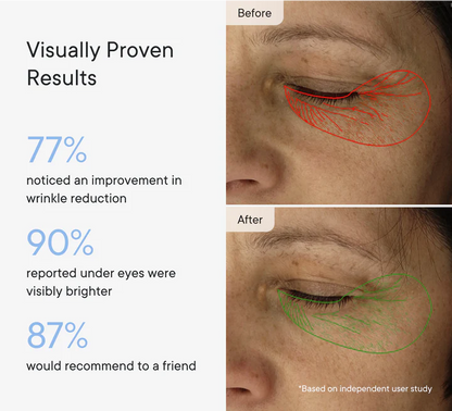 DermaFlect™ Microneedle Under-Eye Patches